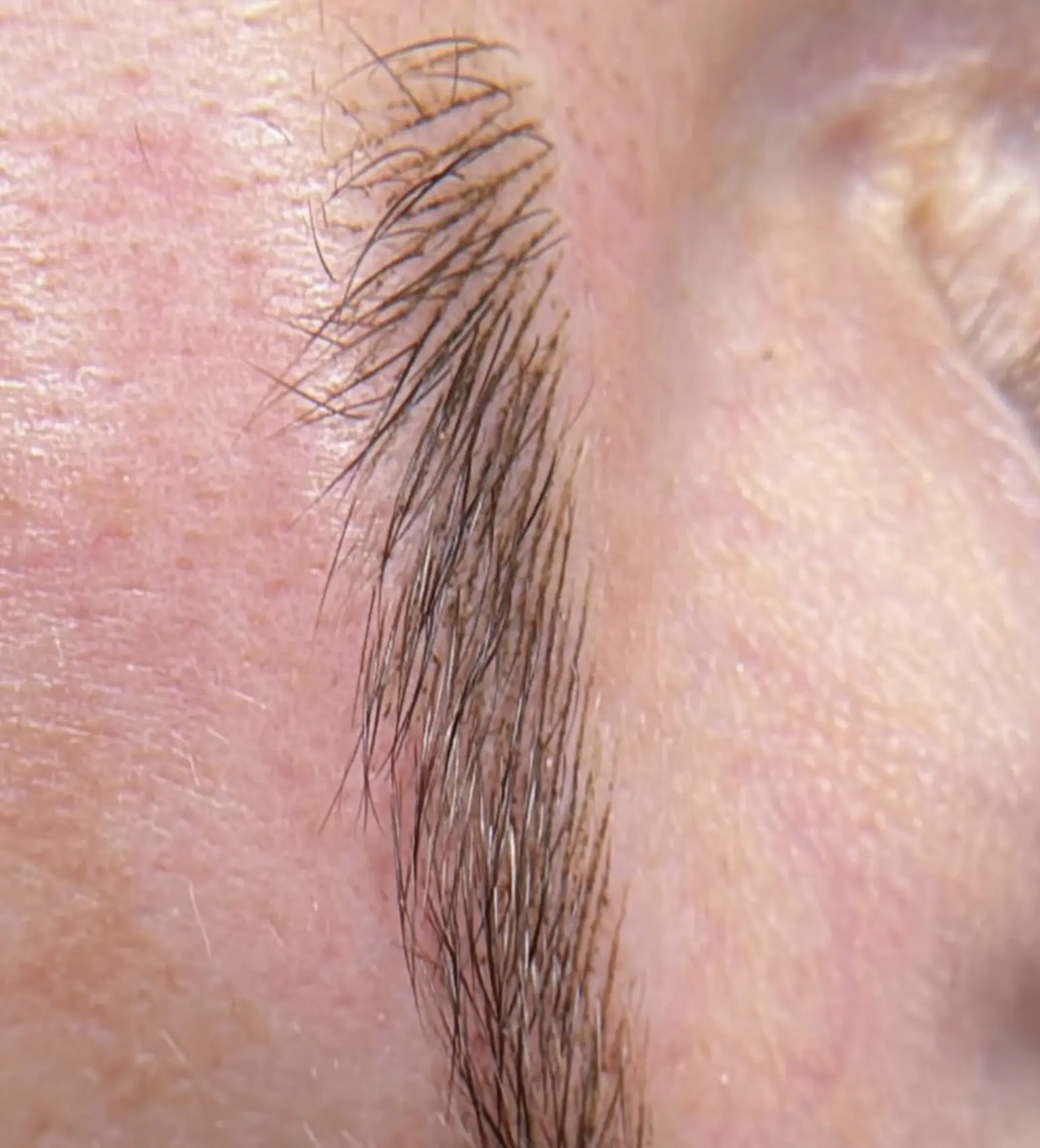 Melbourne client receiving brow tattoo