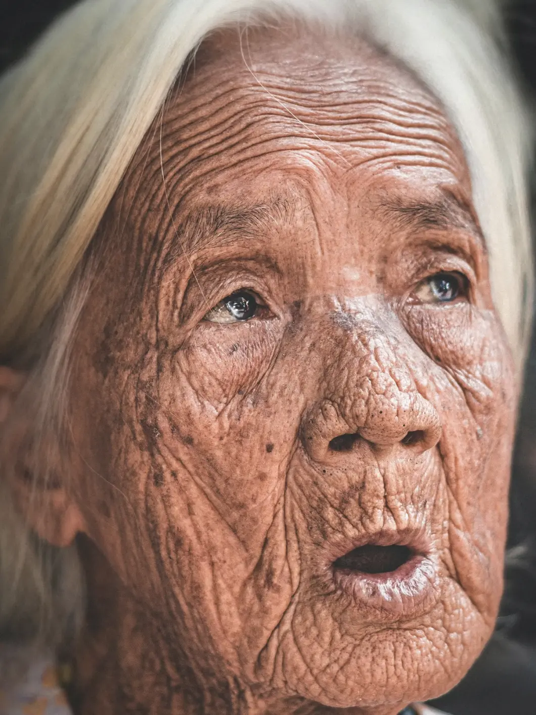 does sun exposure cause most wrinkles