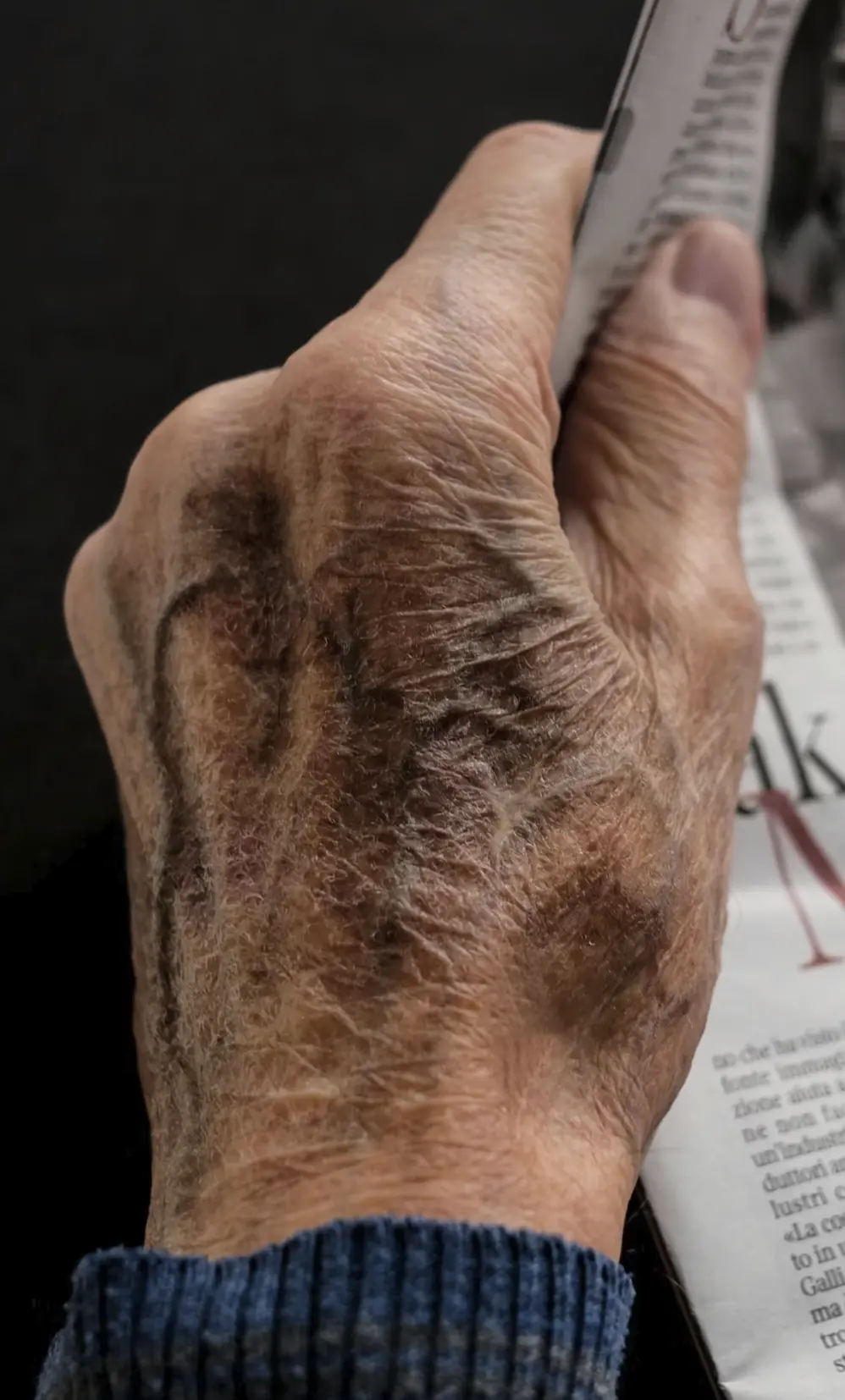how much of wrinkles are caused by sun