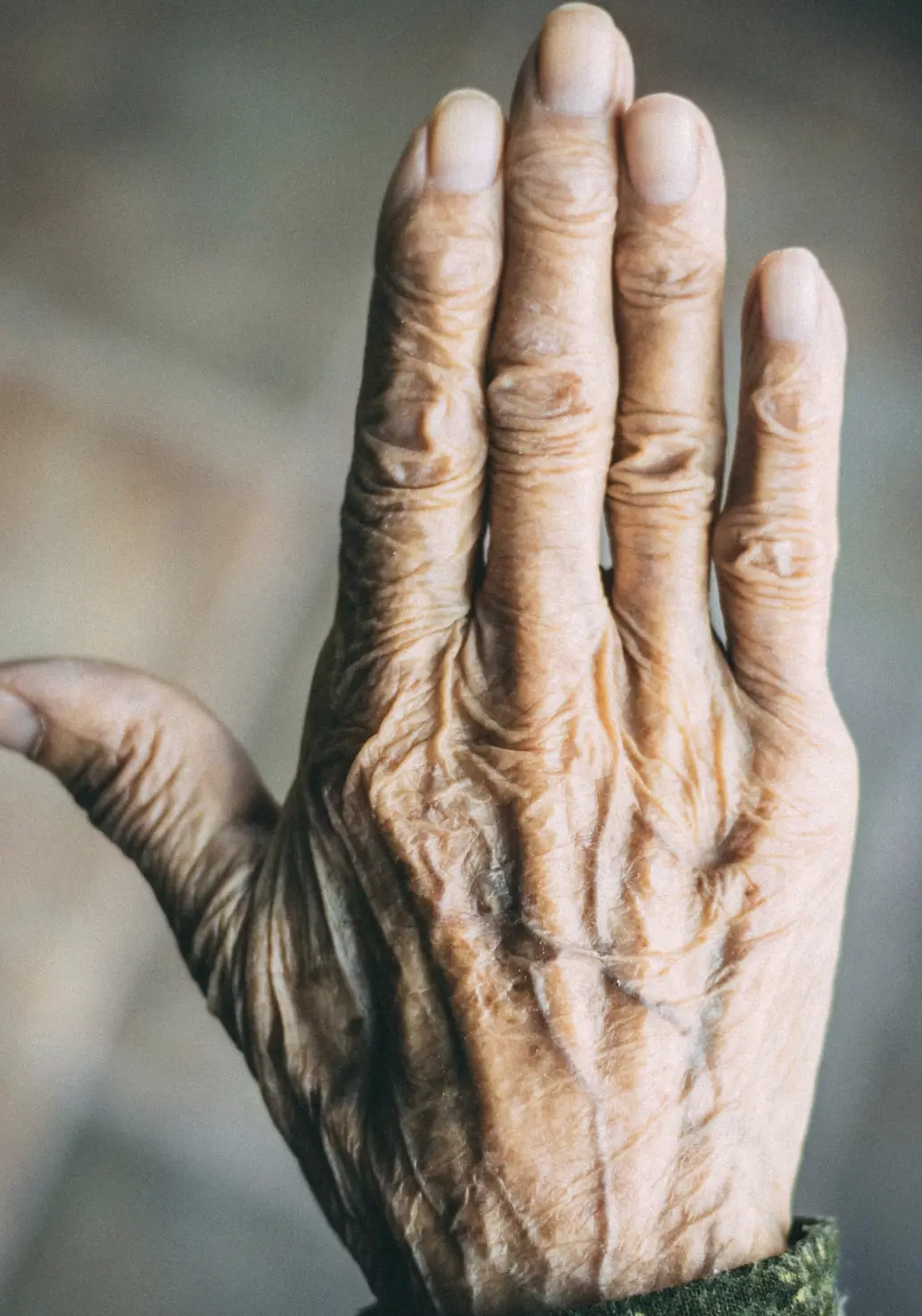 uv radiation and wrinkle formation