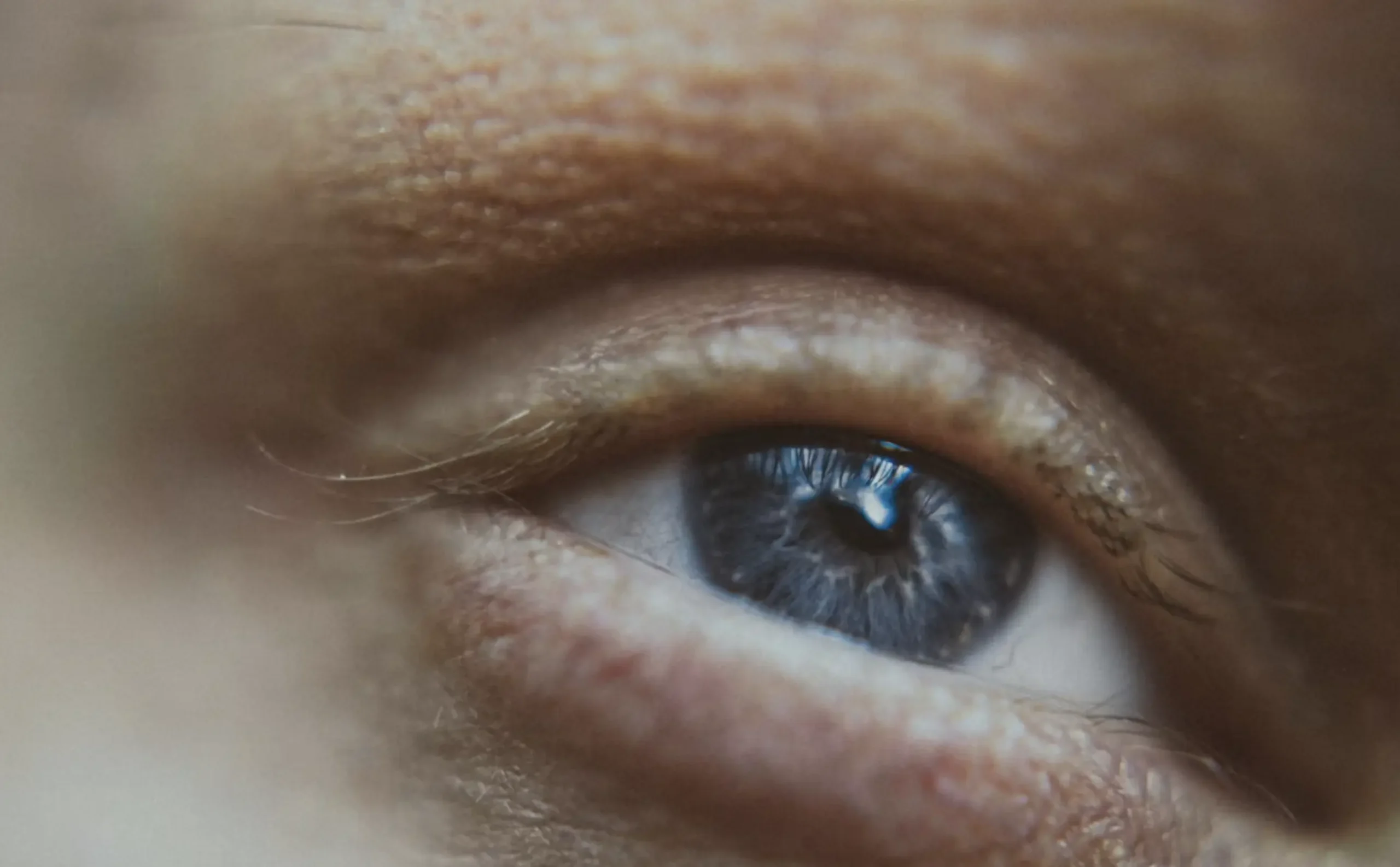 what causes 90 percent of skin wrinkles